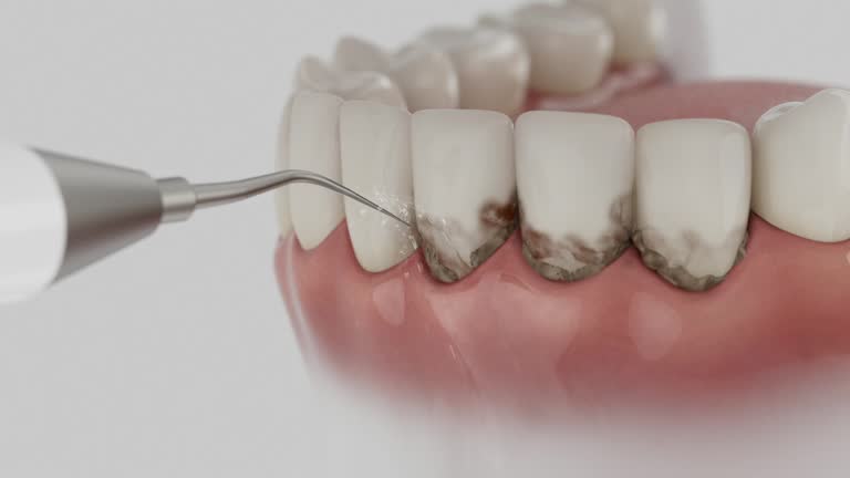 Reliable Dental contractor in Running Springs, CA by Smile Center Dentistry